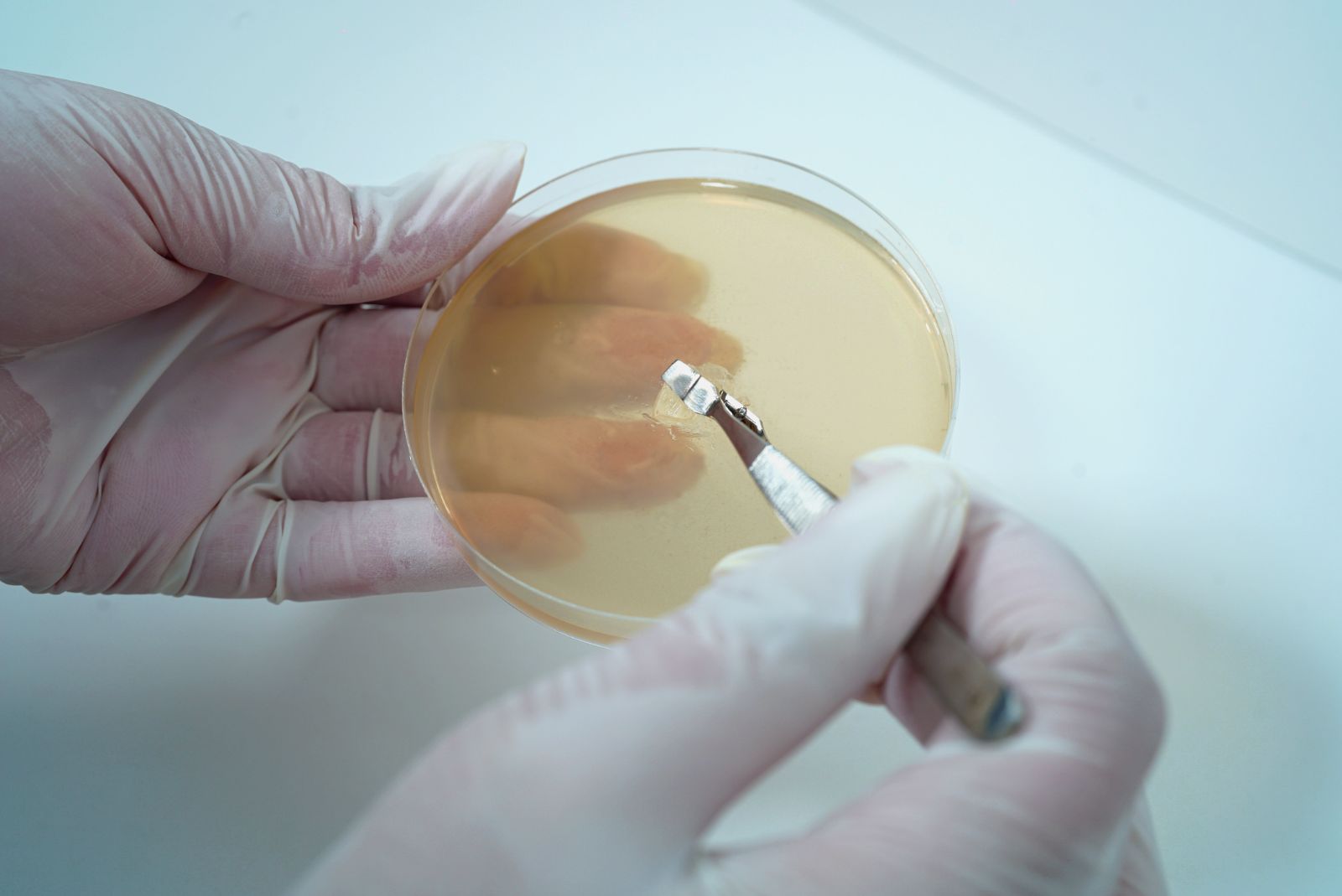 Separation of Mycelium Culture